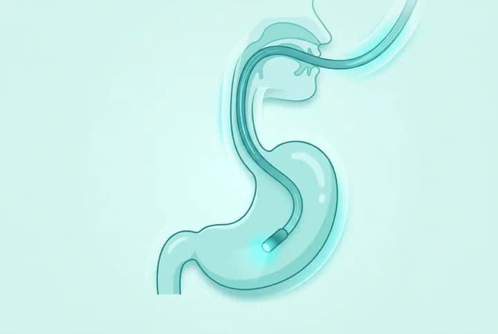 Upper GI Endoscopy