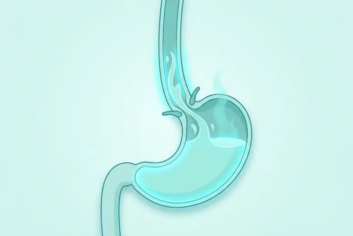 Acid Reflux / GERD