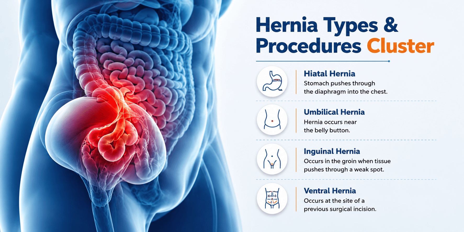 Hernia Types & Procedures Cluster